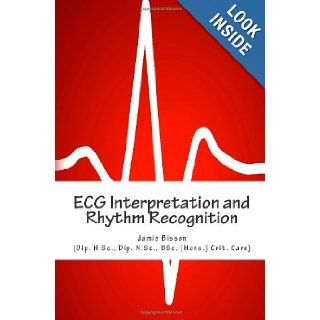 ECG Interpretation and Rhythm Recognition: Mr Jamie Bisson, Dr Peter Fletcher, Dr Cafer Zorkun, Prof Chirk Jenn: 9781479339686: Books