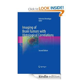 Imaging of Brain Tumors with Histological Correlations eBook: Antonios (Ed.) Drevelegas, Antonios Drevelegas: Kindle Store