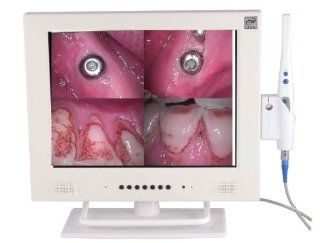 Dental Intraoral Camera Endoscope Mouth Exam WI FI Intra Oral Cam Corded with 15 Inch Monitor M 958A: Health & Personal Care
