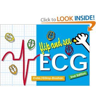 Flip and See ECG, 2e: Elizabeth Gross Cohn RN MS NP ACNP DNSc CEN EMT CC, Mary Gilroy Doohan MD FACEP: 9780721694139: Books
