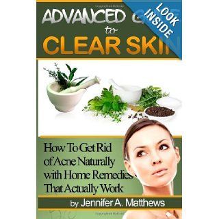 Advanced Guide to Clear Skin: How To Get Rid of Acne Naturally with Home Remedies That Actually Work: Jennifer A Matthews: 9781468181012: Books