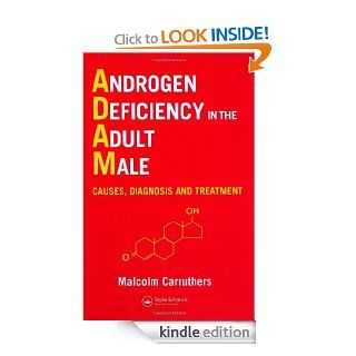 Androgen Deficiency in The Adult Male: Causes, Diagnosis and Treatment eBook: Malcolm Carruthers: Kindle Store