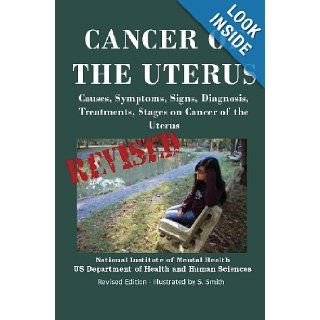 Cancer Of The Uterus: Causes, Symptoms, Signs, Diagnosis, Treatments, Stages Of Cancer of the Uterus   Revised Edition   Illustrated by S. Smith: Department of Health and Human Services, National Institutes of Health, National Cancer Institute, S. Smith: 9