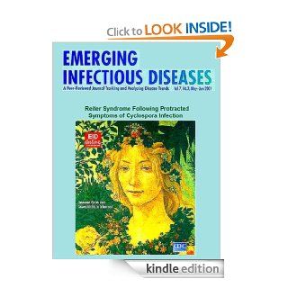 Reiter Syndrome Following Protracted Symptoms of Cyclospora Infection   Kindle edition by Bradley A. Connor. Professional & Technical Kindle eBooks @ .