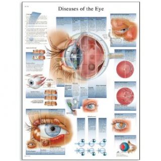 3B Scientific VR1231L Glossy Laminated Paper Diseases of The Eye Anatomical Chart, Poster Size 20" Width x 26" Height: Industrial & Scientific