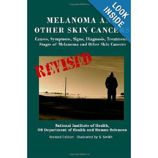 Melanoma And Other Skin Cancers: Causes, Symptoms, Signs, Diagnosis, Treatments, Stages of Melanoma and Other Skin Cancers: U.S. Department of Health and Human Services, National Institute of Health, National Cancer Institute, S. Smith: 9781475017274: Book