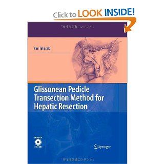 Glissonean Pedicle Transection Method for Hepatic Resection: 9784431489436: Medicine & Health Science Books @