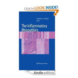 The Inflammatory Myopathies eBook: Lawrence J. (Ed.) Kagen, Lawrence J. Kagen: Kindle Store