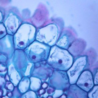 Typical Animal and Plant Cells, sec., Individual Microscope Slide: Industrial & Scientific